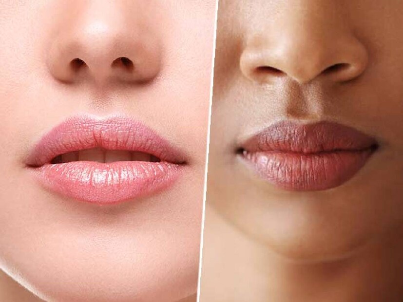 natural remedies for lip pigmentation and lip care ,lip care ,tips to treat dark lips, pigmented lips, lip pigmentation, how to get pink lips, dark lips ,lips health, skincare, beauty tips, simple tips for lip darkness, Health, tinted lip balm, tinted ceramide balm, strawberry lip balms, lip balm, lightening balm, lip care routine, ചുണ്ടിന്റെ കരുവാളിപ്പ് മാറാന്‍ ഈ വഴി,ബ്യുട്ടി ടിപ്‌സ്‌, ചുണ്ട് , ചുണ്ടുകളിലെ കരിവാളിപ്പും ,ചുണ്ടുകളിലെ കരിവാളിപ്പ് , ചുണ്ട് വരണ്ടുപൊട്ടൽ, ഈ കാര്യങ്ങൾ ശ്രദ്ധിക്കൂ, ഹെൽത്ത് ന്യൂസ് , ടിപ്സ് , ലിപ് സ്ക്രബ്ബുകൾ , ചുണ്ടിലെ നിറം വർധിപ്പിക്കാൻ ,