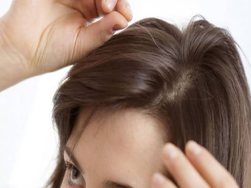 Gray hair, going gray, pluck your grays, pluck gray hair, gray hair myths, gray hair facts, what causes gray hair, how to cover gray hair, how to color gray hair, how to transition to gray hair, how to dye gray hair, best gray hair dyes, how to dye your hair gray, why does hair gray, plucking gray hair, best gray hair coverage, best hair dye for gray hair, grey hair, plucking grey hair, myth of plucking grey hair, does plucking grey hair increase grey hair, hair aging, genetics and grey hair, preventing grey hair, diet and grey hair, antioxidants and grey hair, vitamins and grey hair, hair care, hair health, does pulling out gray hair make more hair grayer, നരച്ച മുടി പിഴുതാല്, നരച്ച മുടി, മുടി നര, നരച്ച മുടി പിഴുതാല്,കൂടുതല് നരയ്ക്ക് കാരണമാകുമോ,സത്യാവസ്ഥ അറിയാം ,നരച്ച മുടി,മുടി,തലയിലെ നരച്ച മുടി,മുടി പിഴുതാല് ,അകാലനര, ഫിയോമെലാനോസൈറ്റുകള്, യൂമെലാനോസൈറ്റുകള്,മെലാനോസൈറ്റ്, ഹെൽത്ത് , ഹെൽത്ത് ന്യൂസ് Gray hair, going gray, pluck your grays, pluck gray hair, gray hair myths, gray hair facts, what causes gray hair, how to cover gray hair, how to color gray hair, how to transition to gray hair, how to dye gray hair, best gray hair dyes, how to dye your hair gray, why does hair gray, plucking gray hair, best gray hair coverage, best hair dye for gray hair, grey hair, plucking grey hair, myth of plucking grey hair, does plucking grey hair increase grey hair, hair aging, genetics and grey hair, preventing grey hair, diet and grey hair, antioxidants and grey hair, vitamins and grey hair, hair care, hair health, does pulling out gray hair make more hair grayer, നരച്ച മുടി പിഴുതാല്, നരച്ച മുടി, മുടി നര, നരച്ച മുടി പിഴുതാല്,കൂടുതല് നരയ്ക്ക് കാരണമാകുമോ,സത്യാവസ്ഥ അറിയാം ,നരച്ച മുടി,മുടി,തലയിലെ നരച്ച മുടി,മുടി പിഴുതാല് ,അകാലനര, ഫിയോമെലാനോസൈറ്റുകള്, യൂമെലാനോസൈറ്റുകള്,മെലാനോസൈറ്റ്, ഹെൽത്ത് , ഹെൽത്ത് ന്യൂസ്