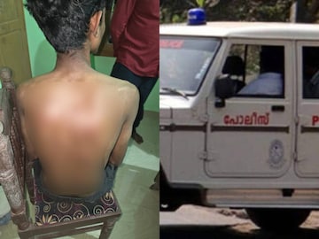 മര്‍ദനമേറ്റ വിദ്യാർത്ഥി